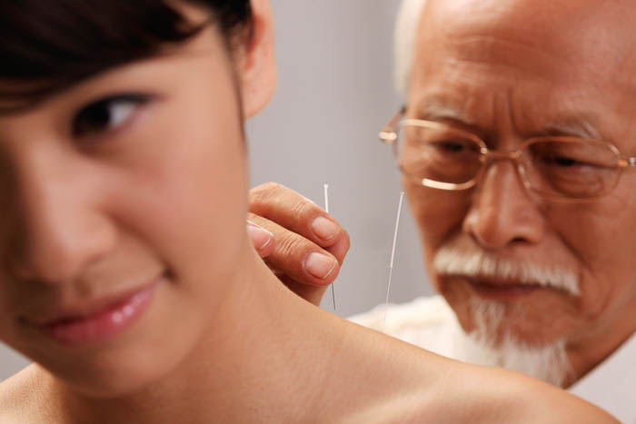 TCM treatment Acupuncture - Chinese Medical Center Amsterdam